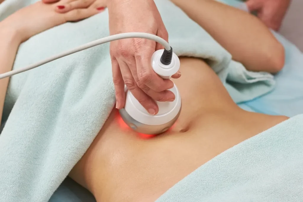 RF Skin Tightening treatment at Lips Boutique® and Beauty Lab in Toronto, ON