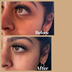 Under Eye BB in Toronto, ON Before and after gallery by Lips Boutique & Beauty Lab