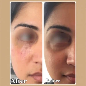 Under Eye cc in Toronto ON by Lips Boutique & Beauty Lab