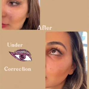 Under Eye Correction Before and After Gallery by Lips Boutique & Beauty Lab