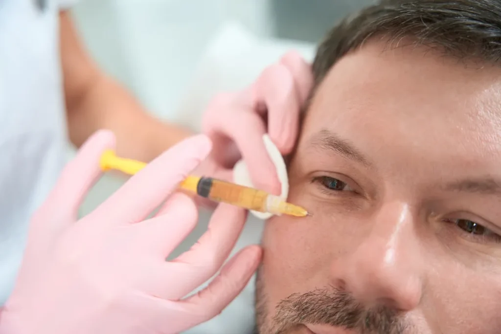 A Man getting PRF treatment at Lips Boutique® and Beauty Lab in Toronto, ON