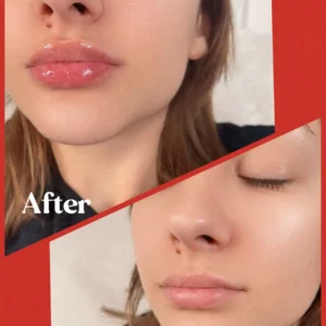 lips before and after by Lips Boutique by JKA Inc in Toronto, On