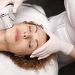 Non-Surgical Face Lifts in Toronto, ON by Lips Boutique & Beauty Lab