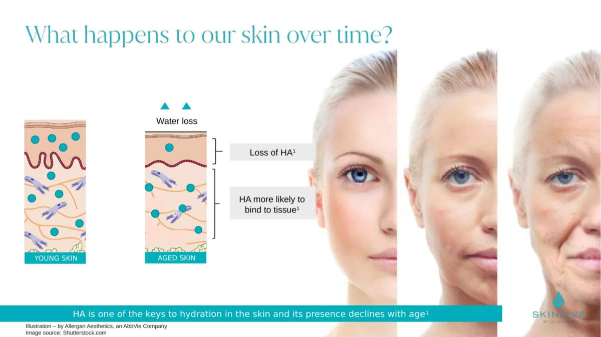 What happens to our skin over time: hyaluronic acid declines with age